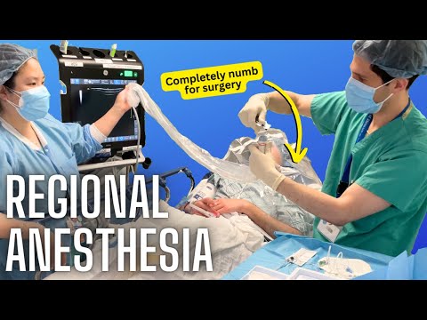 How anesthesiologists numb specific body parts (actual video of a nerve block)