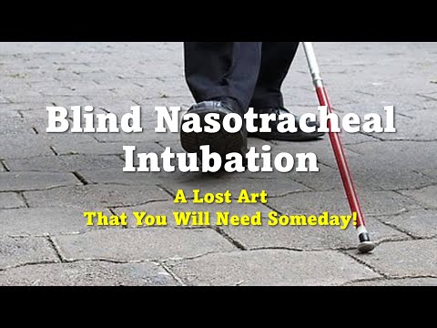 Blind Nasotracheal Intubation Cadaver Demonstration