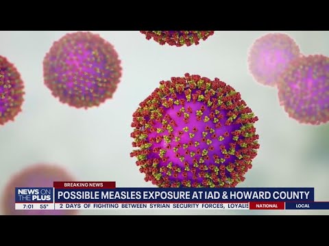 Measles exposure traced to Dulles Airport, Howard County