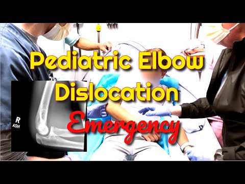 Pediatric Elbow Dislocation: How to Recognize and Treat