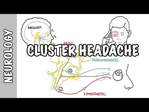 Cluster Headaches - symptoms, pathophysiology, treatment